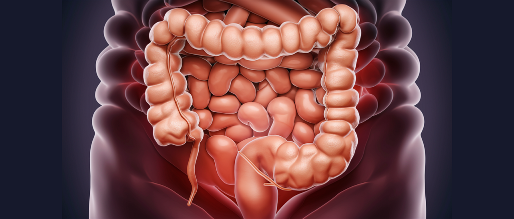 uando eseguire una colonscopia? Guida completa a sintomi, prevenzione e diagnosi